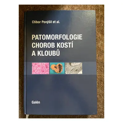 Patomorfologie chorob kostí a kloubů - Ctibor Povýšil