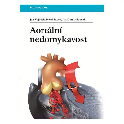 Aortální nedomykavost - Vojáček Jan