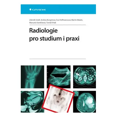 Radiologie pro studium i praxi - Seidl Zdeněk