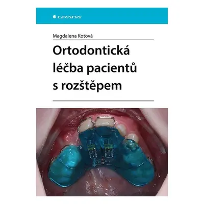 Ortodontická léčba pacientů s rozštěpem - Koťová Magdalena