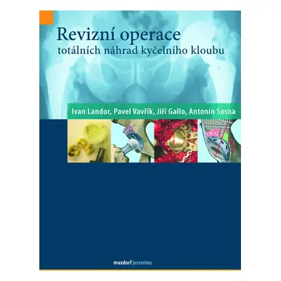 Revizní operace totálních náhrad kyčelního kloubu - kolektiv autorů