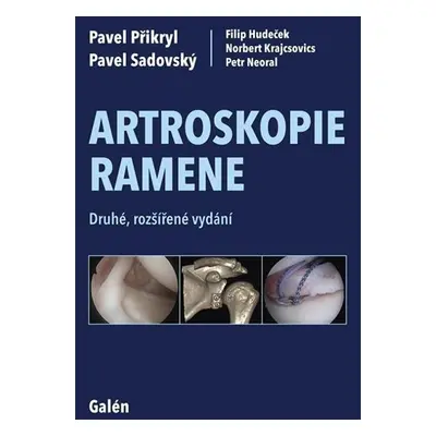 Artroskopie ramene - Přikryl Pavel, Sadovský Pavel, Hudeček Filip, Krajcsovics Norbert, Neoral P