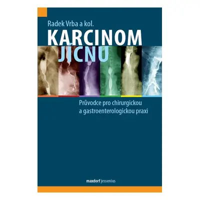 Karcinom jícnu - Průvodce pro chirurgickou a gastroenterologickou praxi - Vrba Radek