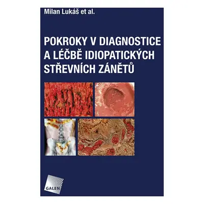 Pokroky v diagnostice a léčbě idiopatických střevních zánětů - Lukáš Milan