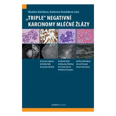 „Triple“ negativní karcinomy mléčné žlázy - Kolečková Markéta, Vomáčková Katherine,