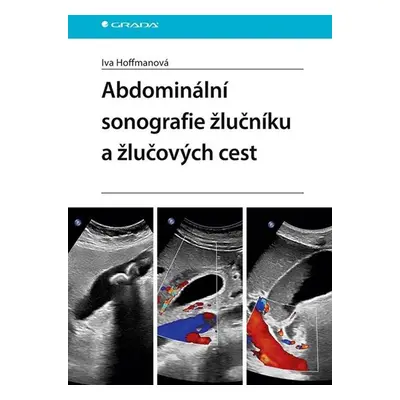 Abdominální sonografie žlučníku a žlučových cest - Hoffmanová Iva