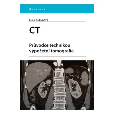 CT - Průvodce technikou výpočetní tomografie - Súkupová Lucie