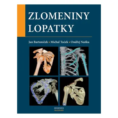 Zlomeniny lopatky - Naňka Ondřej, Bartoníček Jan, Tuček Michal