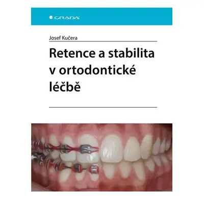 Retence a stabilita v ortodontické léčbě - Kučera Josef