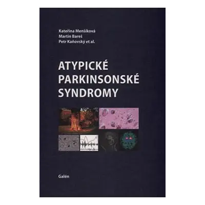 Atypické parkinsonské syndromy - Menšíková Kateřina