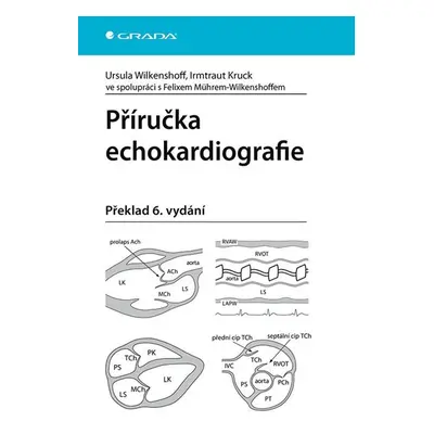 Příručka echokardiografie - Wilkenshoff Ursula, Kruck Irmtraut