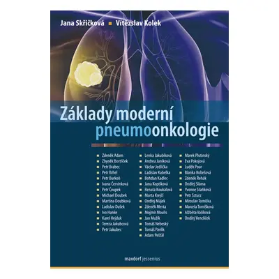 Základy moderní pneumoonkologie - Kolek Vítězslav, Skřičková Jana