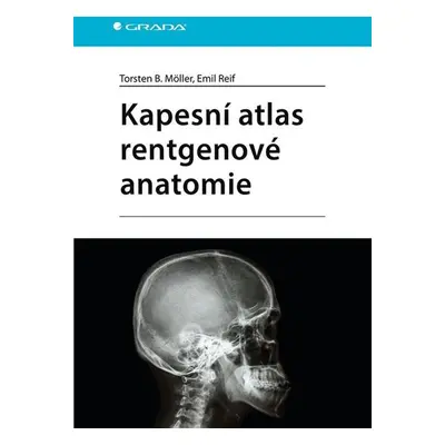 Kapesní atlas rentgenové anatomie - Möller Torsten B.