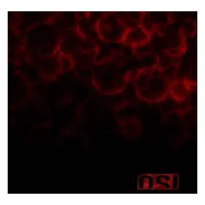 CD OSI: Blood DIGI