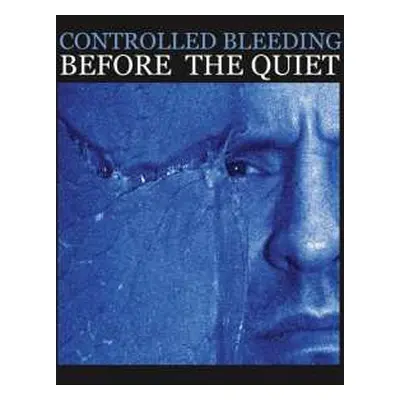 CD Controlled Bleeding: Before The Quiet