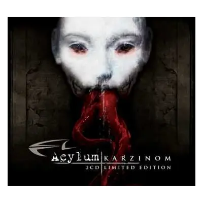 2CD Acylum: Karzinom