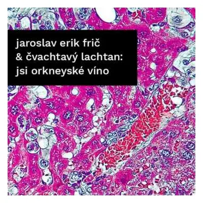 CD Frič Jaroslav Erik & Čvachtavý: Jsi Orkneyské Víno / Ropa