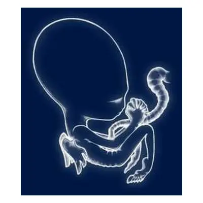 2LP Sigur Rós: Ágætis Byrjun