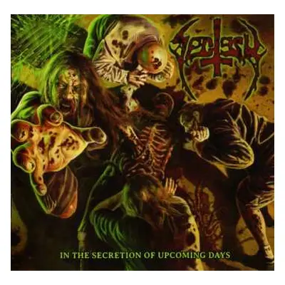 CD Sectesy: In The Secretion Of Upcoming Days