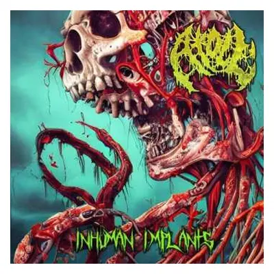 CD Atoll: Inhuman Implants