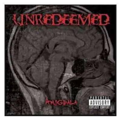 CD Unredeemed: Amygdala