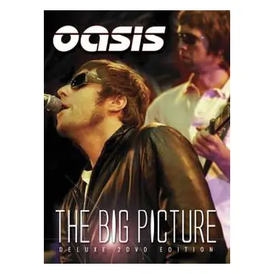 2DVD Oasis: The Big Picture