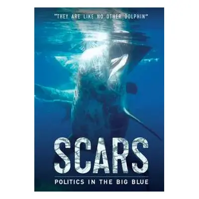 DVD Feature Film: Scars