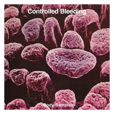 2CD Controlled Bleeding: Body Samples