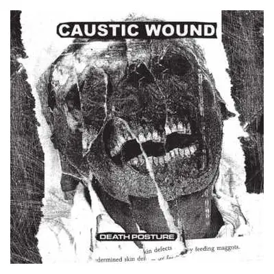 LP Caustic Wound: Death Posture