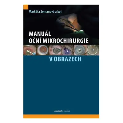 Manuál oční mikrochirurgie v obrazech