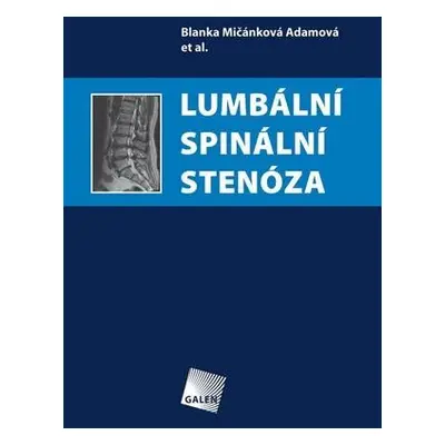 Lumbální spinální stenóza