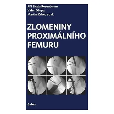 Zlomeniny proximálního femuru - Kolektiv