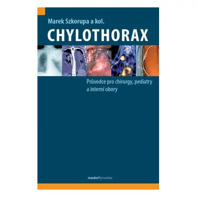 Chylothorax