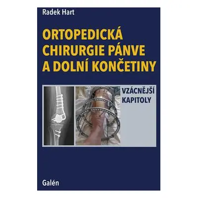 Ortopedická chirurgie pánve a dolní končetiny