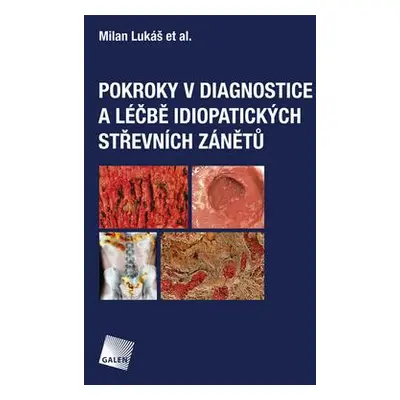 Pokroky v diagnostice a léčbě idiopatických střevních zánětů