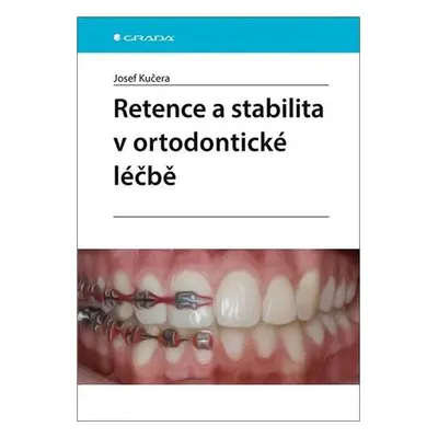 Retence a stabilita v ortodontické léčbě