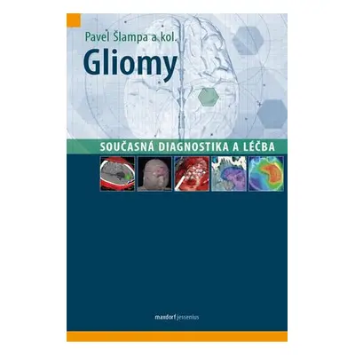 Gliomy - současná diagnostika a léčba