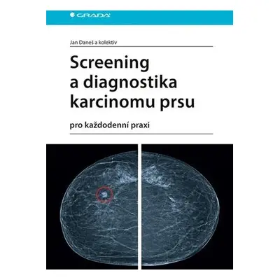 Screening a diagnostika karcinomu prsu