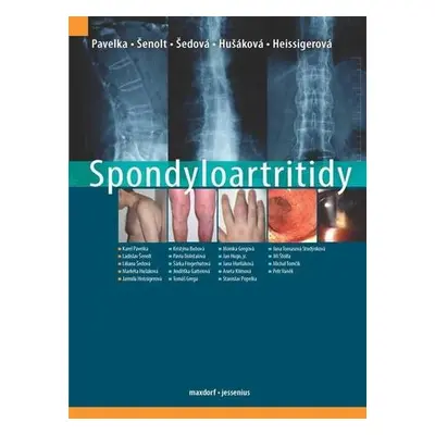 Spondyloartritidy - Karel Pavelka; Ladislav Šenolt; Liliana Šedová