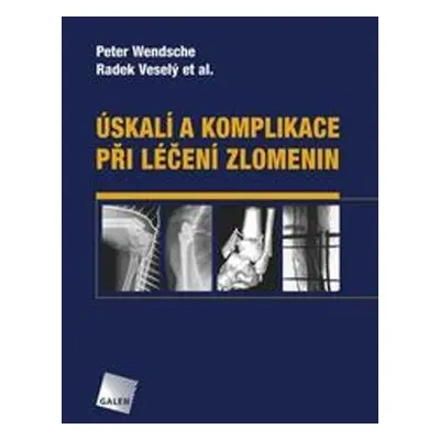 Úskalí a komplikace při léčení zlomenin - Radek Veselý