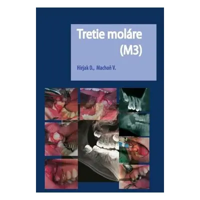 Tretie moláre (M3)