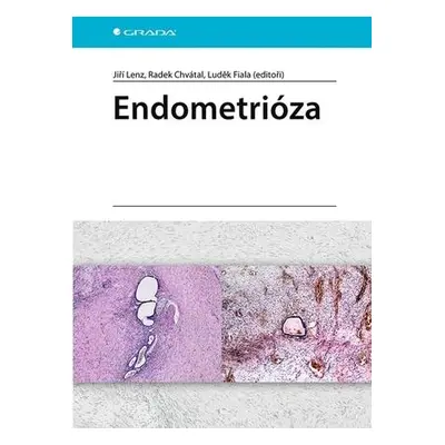 Endometrióza