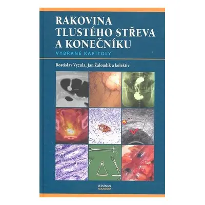 Rakovina tlustého střeva a konečníku - vybrané kapitoly Vyzula Rostislav, Žaloudík Jan a kolekti