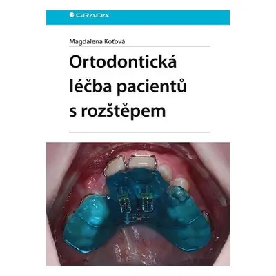 Ortodontická léčba pacientů s rozštěpem