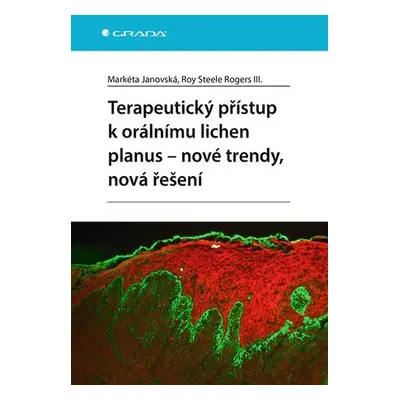 Terapeutický přístup k orálnímu lichen planus - nové trendy, nová řešení