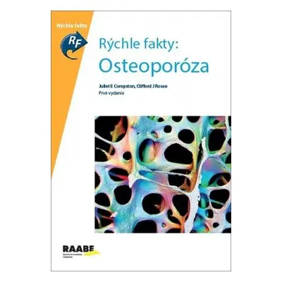 Osteoporóza - Juliet Compston, Clifford E. Rosen