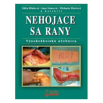 Nehojace sa rany