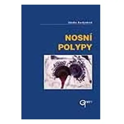 Nosní polypy