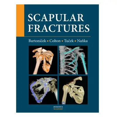 Scapular fractures