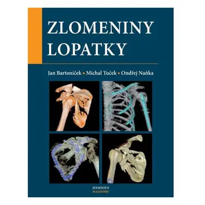 Zlomeniny lopatky